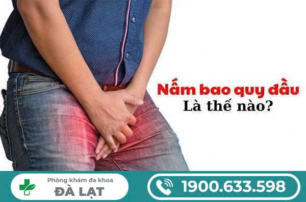 Hình ảnh minh họa